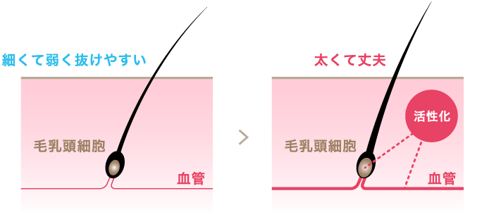 細くて弱く抜けやすい状態から太くて丈夫な毛乳頭細胞へ活性化(イラスト)