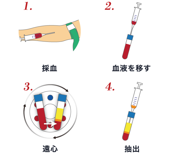 1. 採血 → 2. 血液を移す → 3. 遠心 → 4. 抽出 (イラスト)
